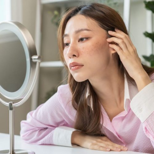 5 dicas para proteger sua pele dos danos causados pela luz azul