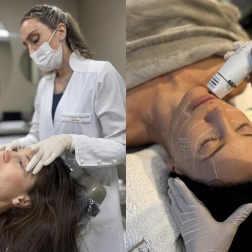 Júlia Pereira aposta em estética preventiva e escolhe clínica de Porto Alegre para cuidados faciais com foco na naturalidade